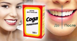 сода