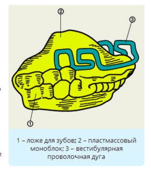 Ортодонтический аппарат