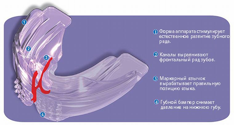 Конструкция трейнера для зубов