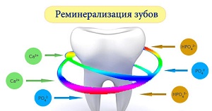 Реминерализация