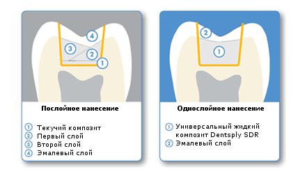 Нанесение композитов