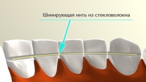 шина стекловолокно
