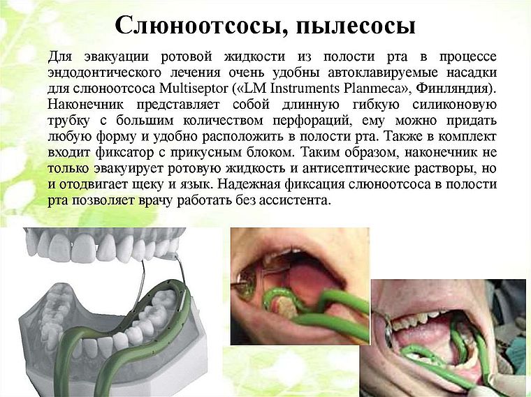 что такое слюноотсос