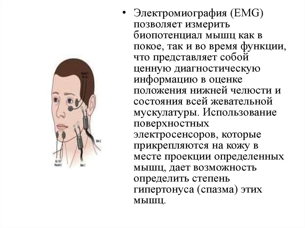Задачи электромиографии