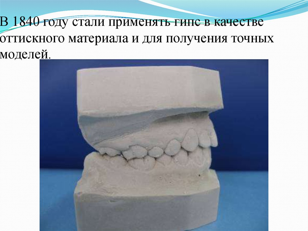 Гипс