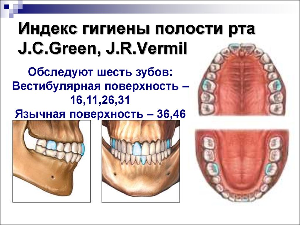 Грина Вермильона