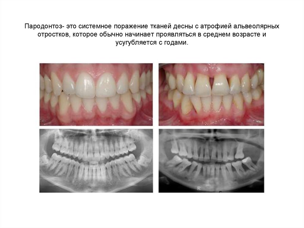 Рентген зубов