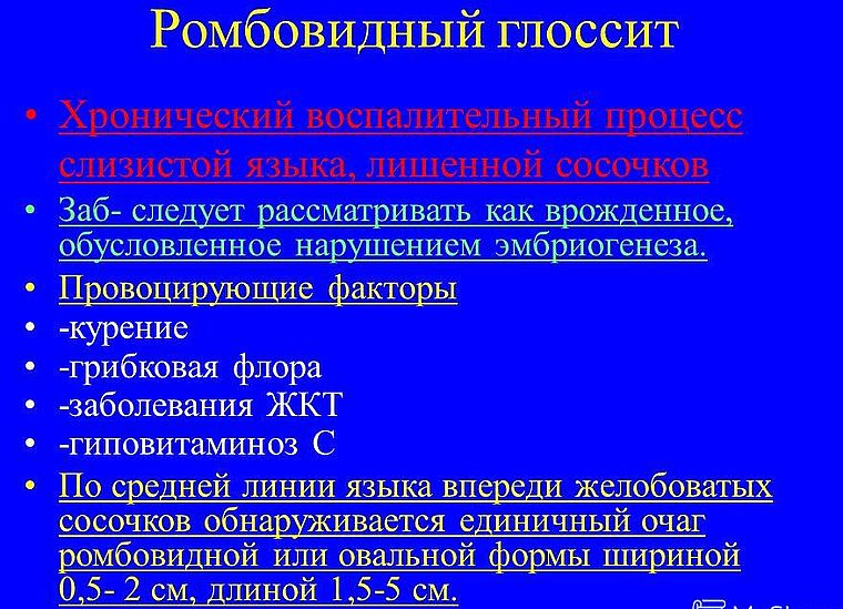 ромбовидный глоссит