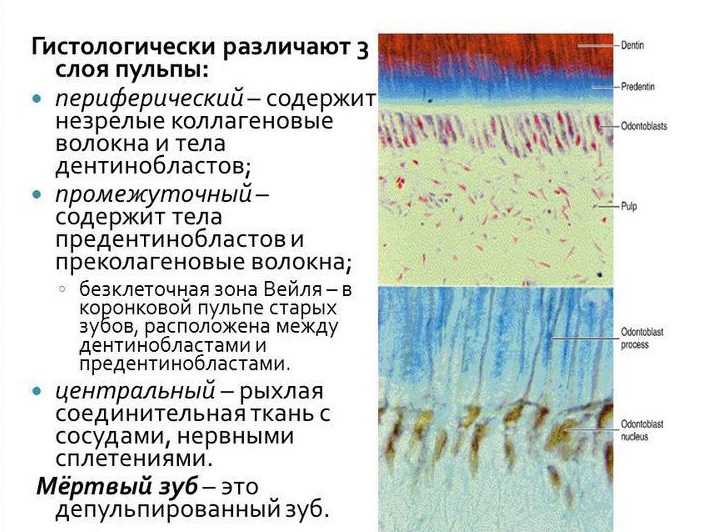 Состав пульпы