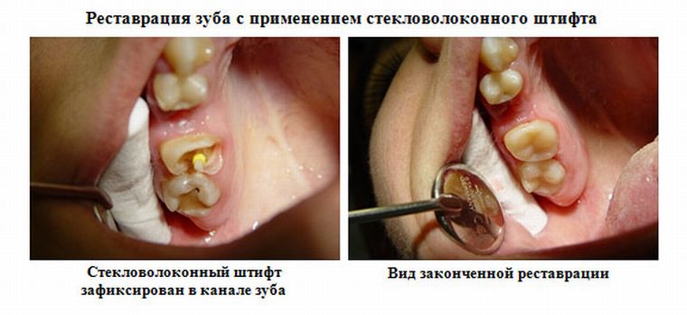 до и после установки