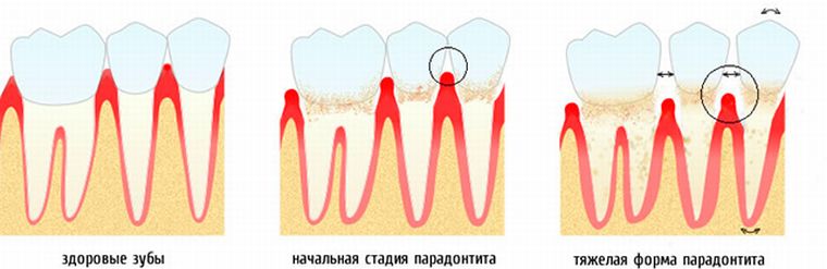 Степени подвижности зубов