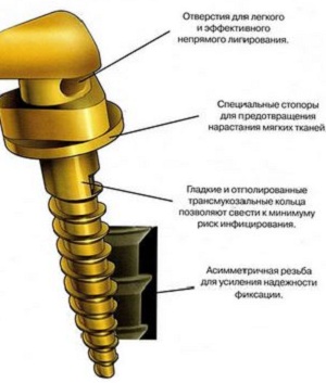 Строение ортодонтического стержня