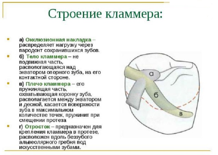 Строение кламмера