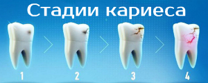 Главный враг стоматолога