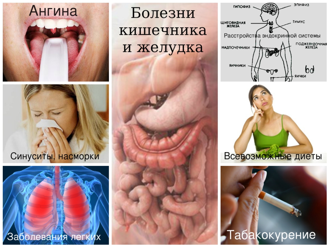 Причины запаха изо рта