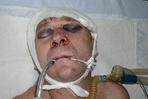 повязка на голове