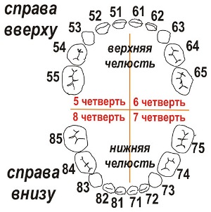система Виола для молочных зубов