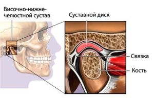 дисфункция ВНЧС