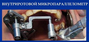 Микропараллелометр