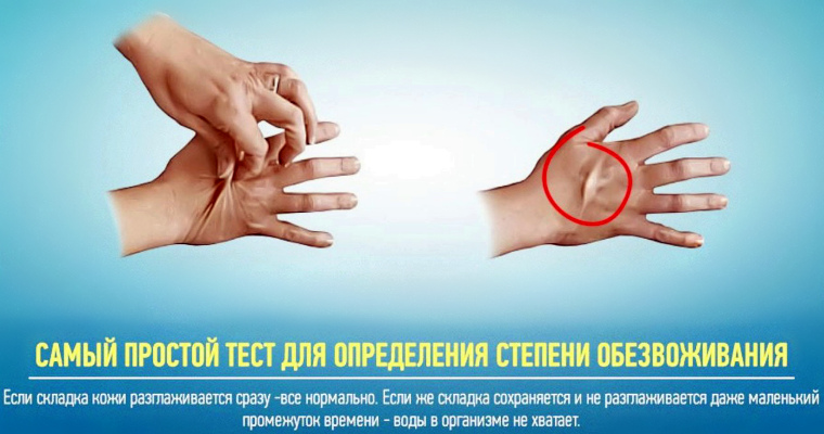 Тест на обезвоживание