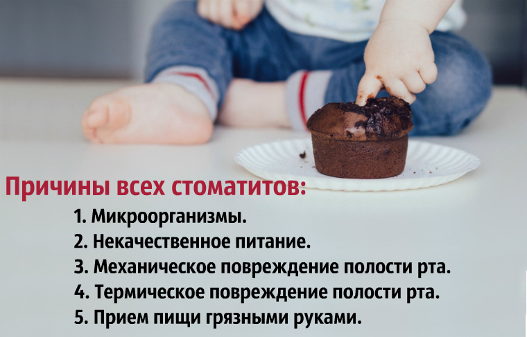 Причины детского стоматита